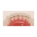 Retainers Wire